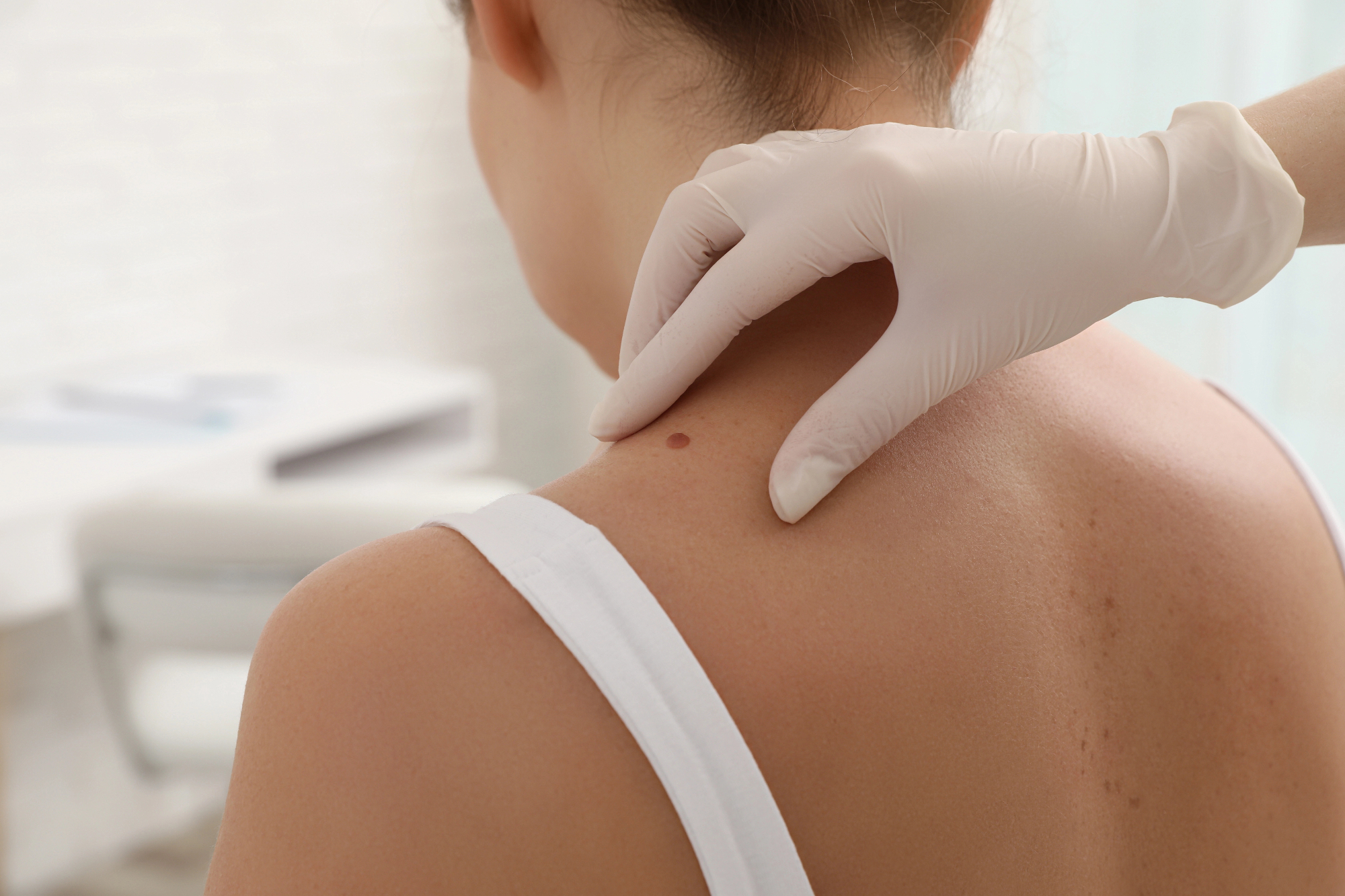 Nikoli si nisem mislil da mi bo dermatologija tako pomagala